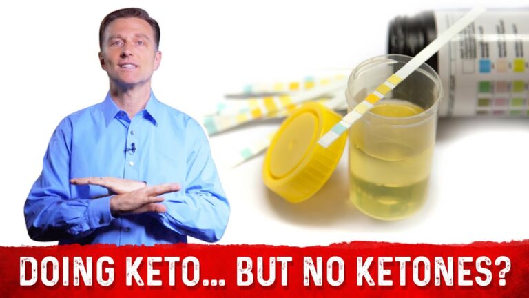 In Ketosis But No Ketones In Urine? – Dr.Berg Answers Why