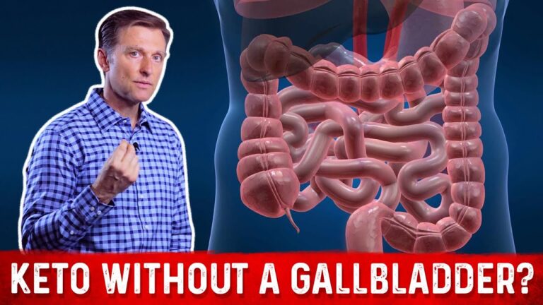 Can I do a Ketogenic Diet Without a Gallbladder? – Dr. Berg on Keto Diet Without Gallbladder